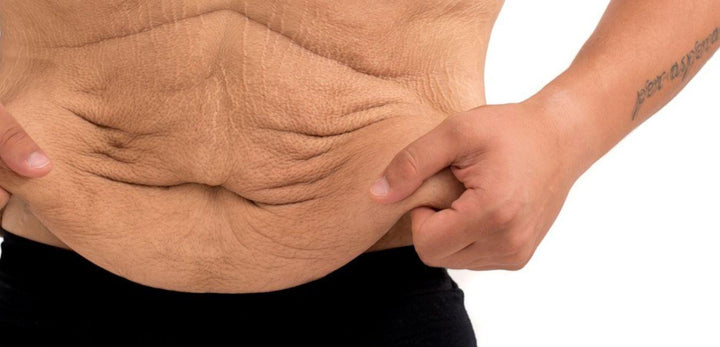 No consigues quemar la grasa abdominal? ¡La abdominoplastia te ayudará! –  BOXSR