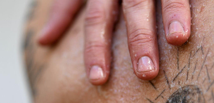 Cómo arreglar las uñas mordidas en hombres - BOXSR - rutinas de cosmética masculina natural, cuidado personal para hombres